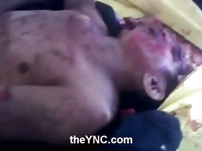 Mans Crushed Face Chillin in the Morgue 