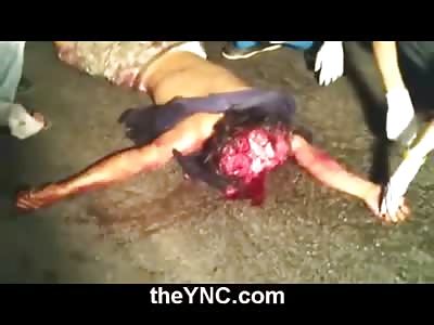 GOOD GORE: Dead Mans Brain Swelling on the Road