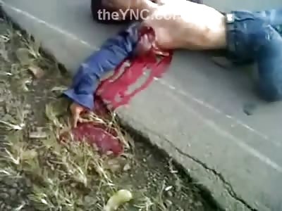 Mangled Biker Arm Ripped from Socket Bleeding Out is Still Gasping for Air 