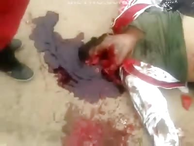 Couple Die together Both Heads Crushed