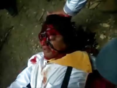 The Brutal Aftermath of a Bull Horns Through his Face