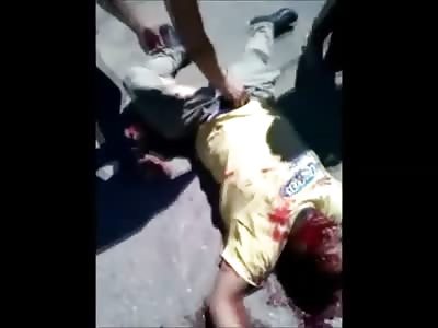 One Man Dead Another Lays in Complete Agony After Motorcycle Accident