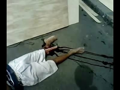 Man Dead from Workplace Injury Death from Shock