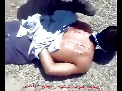 Man Being Horrifically Tortured with Cuts and Salt (Literally Pouring Salt in the Wounds)