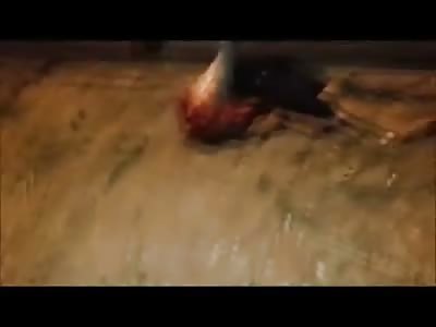 The Result of Hitting a Guard Rail When you Lose Control of Your Death Trap Motorcycle Going 110mph