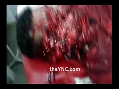 Unbelievably Shock Video of Mans Face Shredded by Machete and Still Alive 