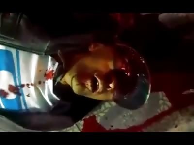 Short Video of Man Shot in the Forehead and Trying to Breathe 