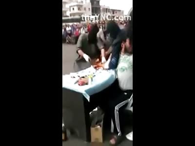 Man has his Hand Cut Off at a Hand Cut Off Station on the Side of the Road 