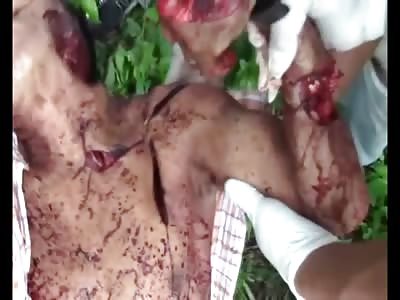 Different Clear Footage of a Brutal Machete Attack