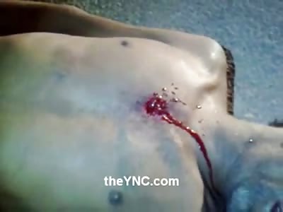 Man Shot in the Chest Bleeds out on the Street Fighting to Stay Alive