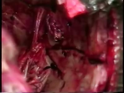 Mans Brains Literally Shot Out