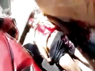 This Girl Has Minor Scratches ... But When you See Her Boyfriend in the Yellow Shirt