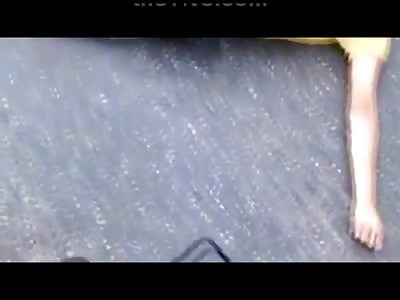 Girl in Boys Boxers and a Yellow Shirt Goes into Massive Convulsions on the Street after Accident