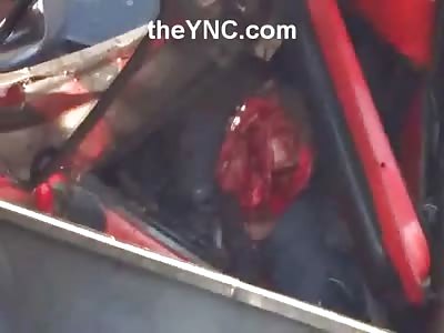 Brutal Head on Collision Between two Trucks Leaves one Driver Headless... Crowd Can't Get Enough Pictures