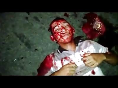 Thug Shot in the Head by Police Lays on the Ground Still Alive but Dying