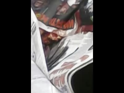 Woman and Her Daughter Dead after an Accident... Womans Eye Popping out