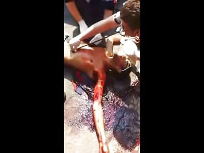 Man Dies Slowly on Camera After Being Shot in the Armpit