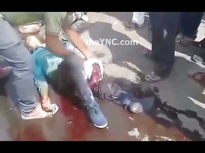 Shock Video shows Man in Utter Terror from Pain with his Leg Ripped Off....Female has her Vagina Torn Apart 