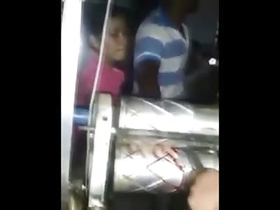 Poor Guys Hand is Crushed at Work