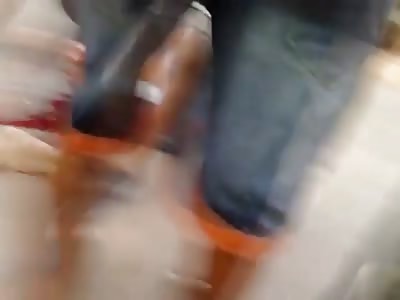 Oh Boy..Man with Split Leg sits Patiently waiting for Help...Leg and Knee Exposed through Broken Skin