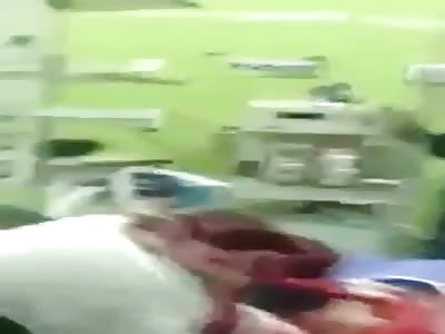 He Can't Be?!! Absolutely Brutal Facial Injury 