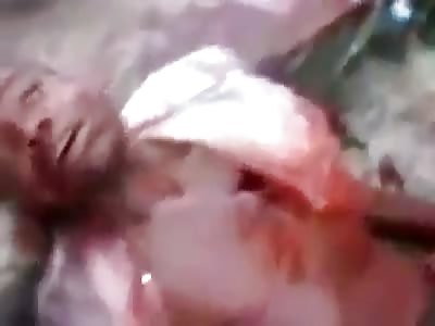 Last gasps of a bandit shot by police in Rio de Janeiro