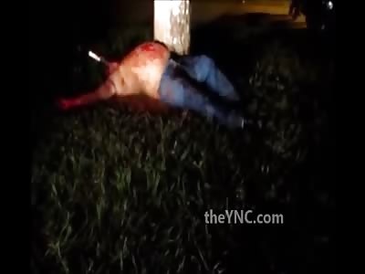 Fat Man with a Huge Knife Stuck in his Face and Still Alive