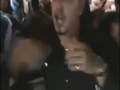 Young scooter girl face crushed in accident