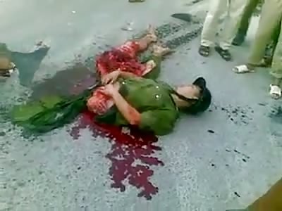  Cut in Half, Still Alive and Talking to Bystanders