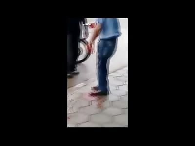 Wife Issues..She Cut this Man's Hand Off in a Domestic Dispute 