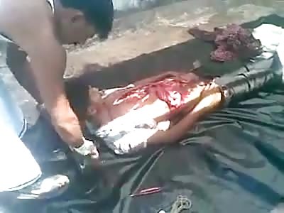 I Guess in India they do Autopsies in the Street? 