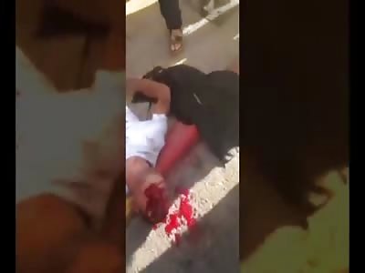 Young palestine man drowning in his blood after being shot by Israeli police