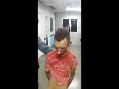 Something Tells Me This Guy in Police Custody Got FUCKED Up 