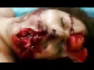 HORRIBLE - Gunshot Suicide Gone Bad and its Female