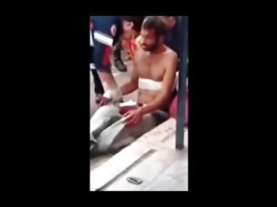 Dude in Shock but Alive has a Full Blown Knife Sticking out of His Head