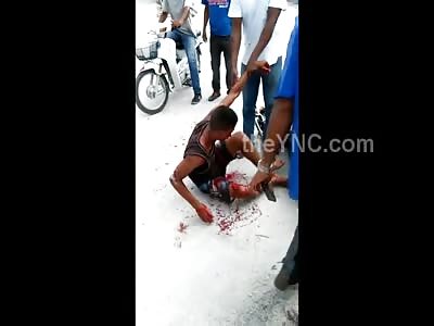 His Face Severely Injured After Accident and Lying in Total Agony