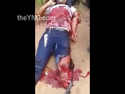 Very Calm Guy with his Leg Ripped Off has to Finnish his Text and Make a Call