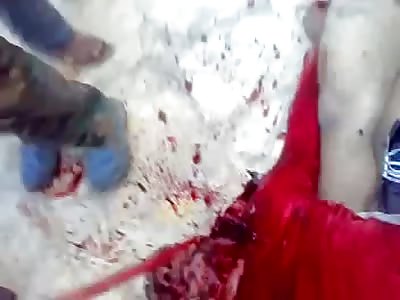 SHOCKING Video Shows Two Men Castrated and Tortured ... Was that a Pick Axe to the Face?