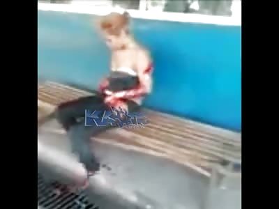 Girl Carrying Her Own Chopped Off Hand !