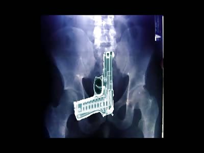 Some blood , brain , guts 8.