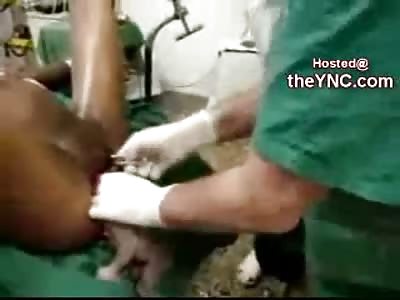 Really Really late Abortion video