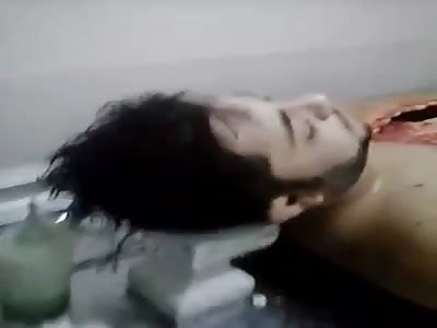 Autopsy of Cristiano Araujo, Famous Brazilian Singer