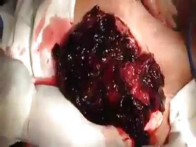 Was applied pump and got screwed