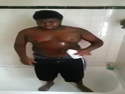 Self-Immolation Stunt Goes Bad Real Fast 