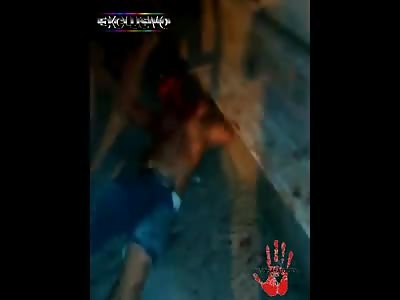 FACE LIFTING IN BRAZIL SPA