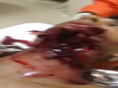 DOCTOR, I HAVE A LITTLE PROBLEM ON THE CHIN