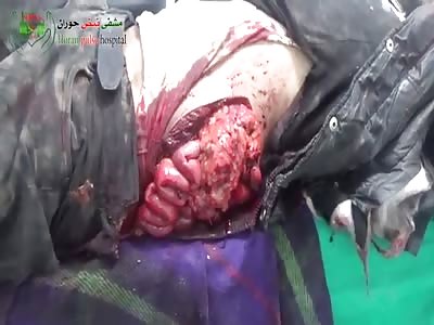 MAN IN CRITICAL CONDITION