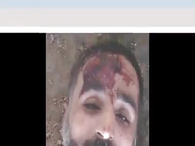 HUNDRED DEAD - CHOOSE THE MORE UGLY