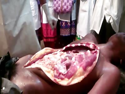 AUTOPSY OF A POISONED MALE DEAD BODY