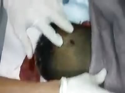 Shot in the back of the head